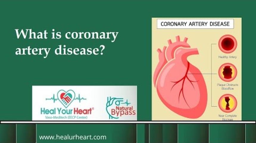 what is coronary artery disease