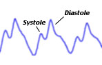 treatment level bypass surgery