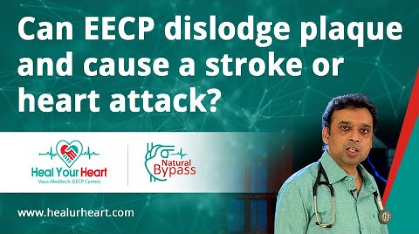 can eecp dislodge plaque and cause stroke or heart attack