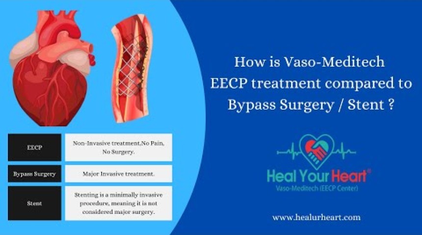 how is vaso meditech eecp treatment compared to bypass surgery stent
